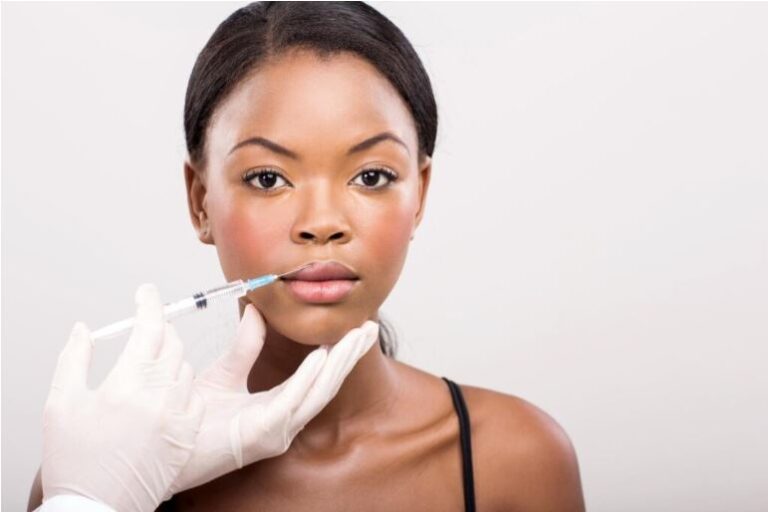 Dermal Fillers treatment of skin of color