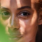 skin cancer on skin of color