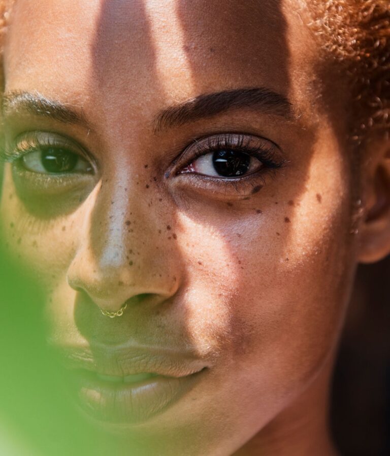 skin cancer on skin of color