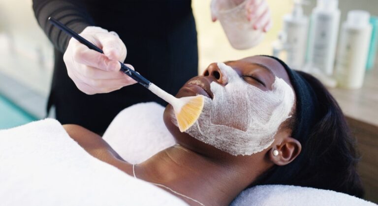 Chemical Peels treatment on African American woman