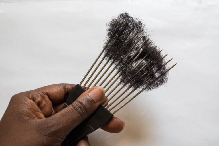 HAIR BREAKAGE IN WOMEN OF COLOR HAIR BREAKAGE IN WOMEN OF COLOR