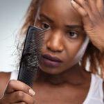 HAIR LOSS IN WOMEN OF COLOR: FEATURES, CAUSES AND TREATMENT