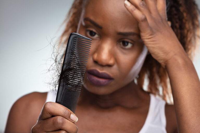 HAIR LOSS IN WOMEN OF COLOR: FEATURES, CAUSES AND TREATMENT
