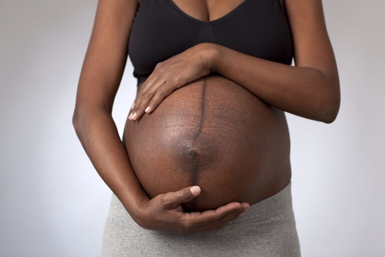 THE EFFECTS OF PREGNANCY ON THE SKIN AND HAIR OF WOMEN OF COLOR