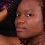 Types Of Acne of skin of color