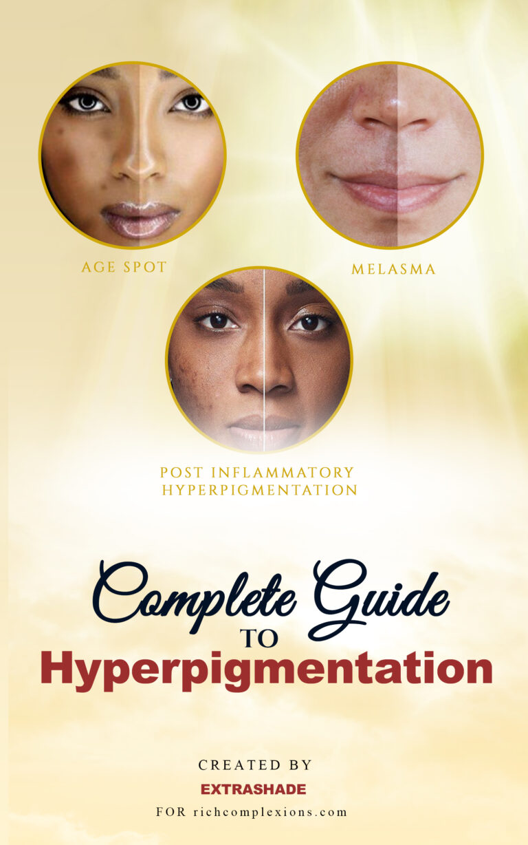 Complete guide to hyperpigmentation pdf download