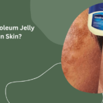 Does Petroleum Jelly Darken Skin