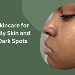 Skincare for Oily Skin and Dark Spots