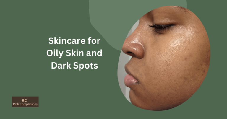 Skincare for Oily Skin and Dark Spots
