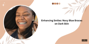 Navy Blue Braces on Dark Skin