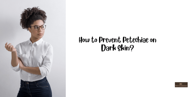 How to Prevent Petechiae on Dark Skin? How to Prevent Petechiae on Dark Skin